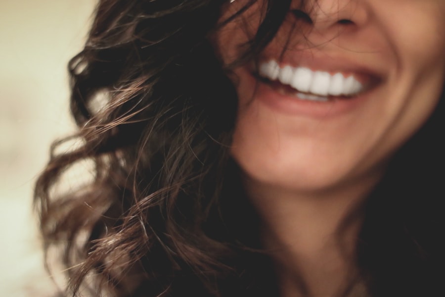 Composite bonding smile transformation result — Dr. Dt. Tuba Akcakus Battal